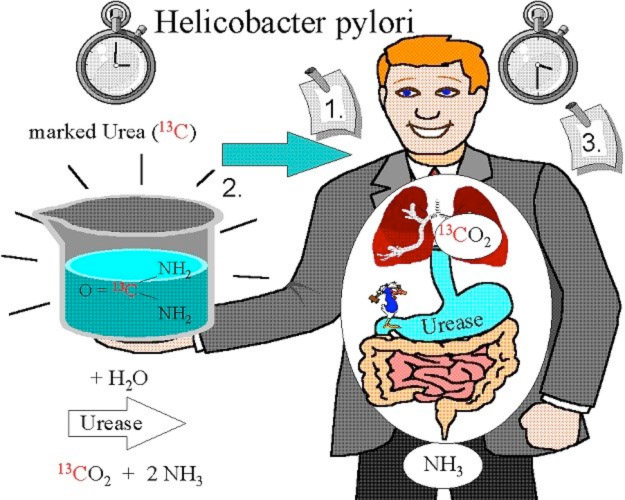 Helicobacter Pylori Diagnose.jpg